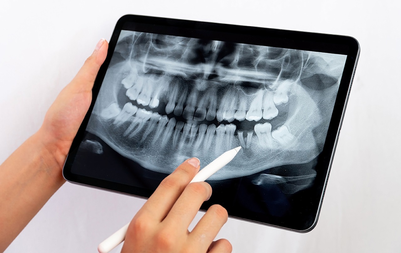 A provider reviewing an x-ray of a patients teeth