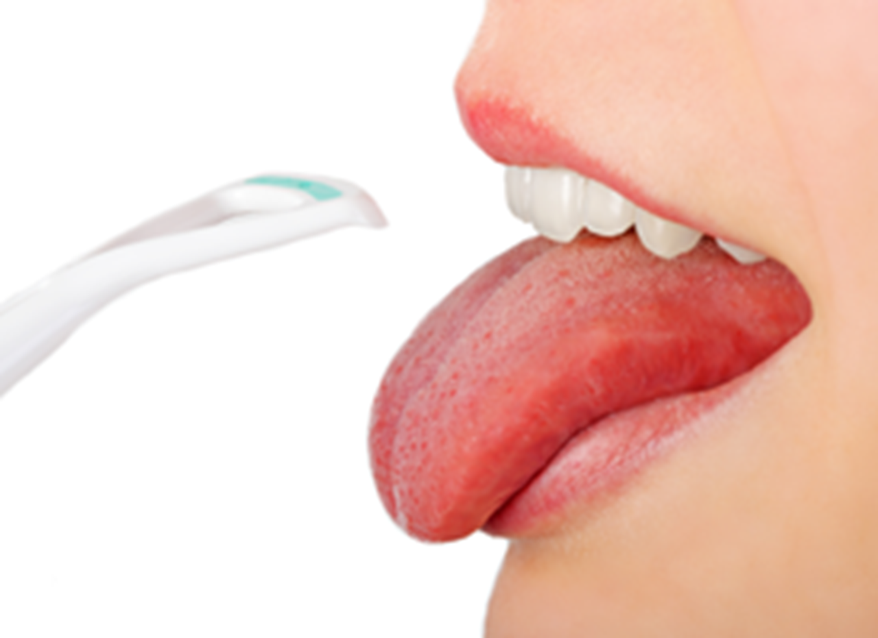 Tongue Scrapers and Cleaners  MouthHealthy - Oral Health Information from  the ADA