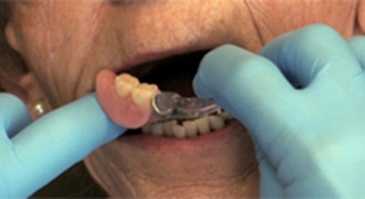 MouthHealthy image