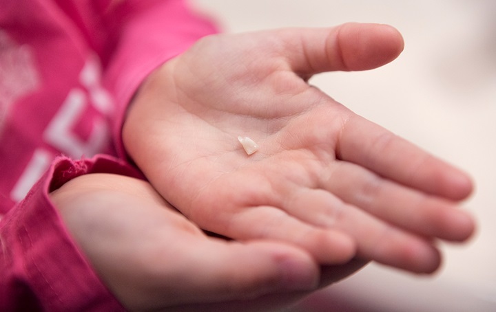 Childs hands holding a lost tooth