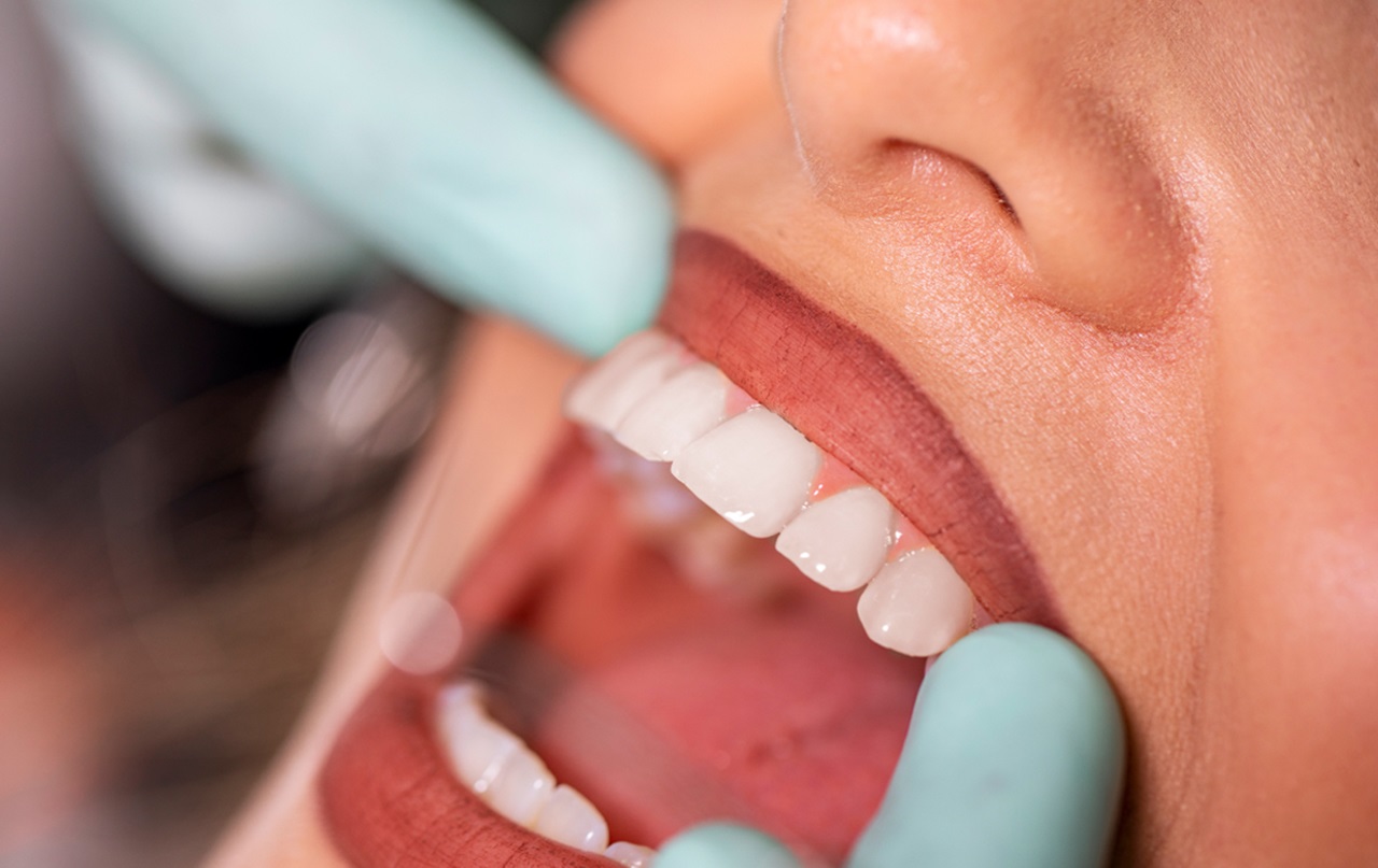 A dentist is examining their patients teeth to check for Oral Cancer.