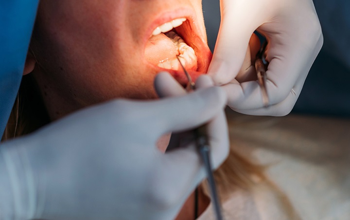 Dentist working on a patient's mouth