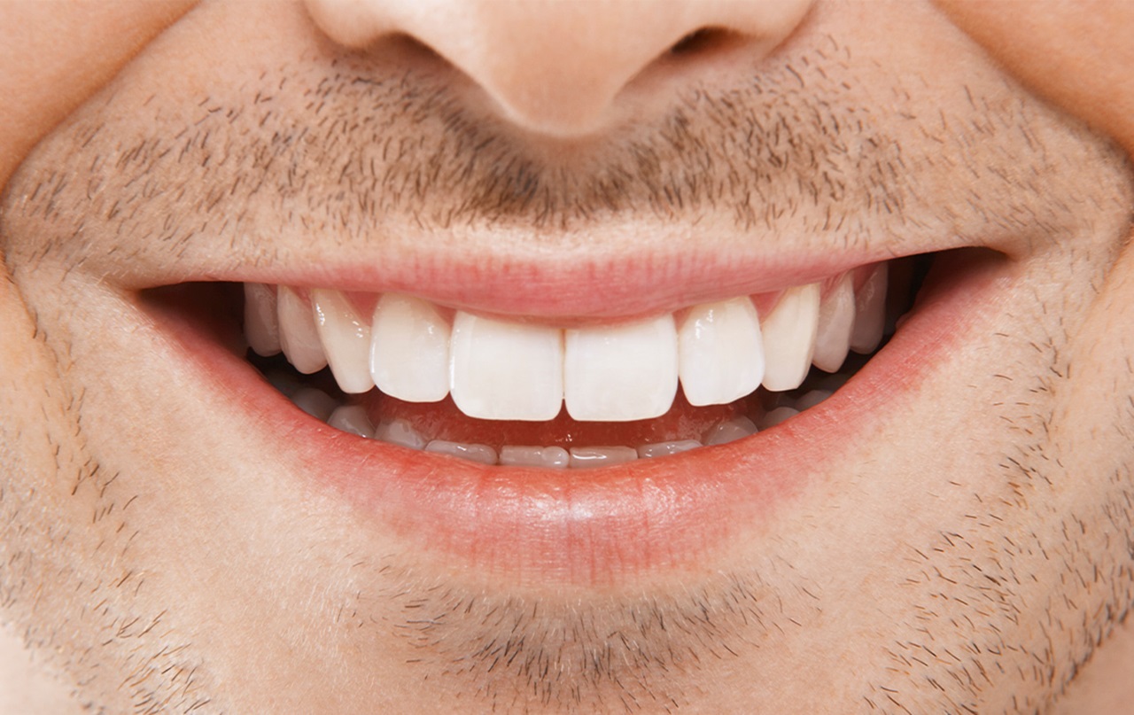 MouthHealthy man smiling with veneers