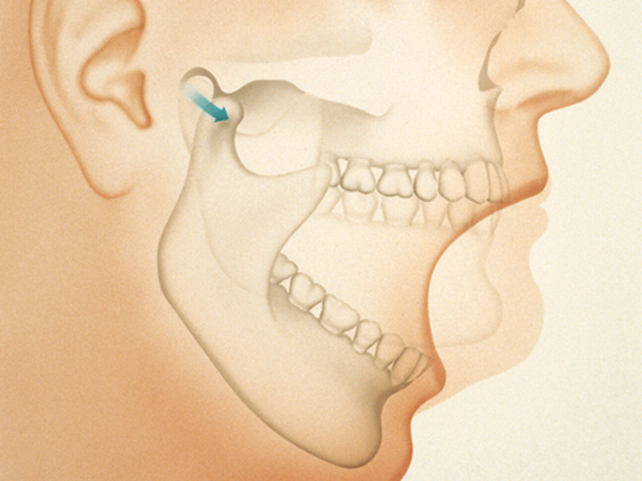 Diagram of jaw bone and joint