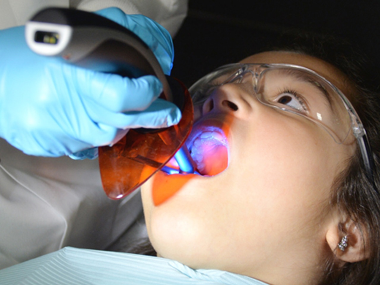Child getting a sealant
